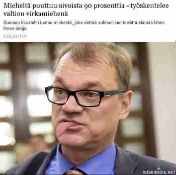 Mieheltä puuttuu 90 prosenttia aivoista