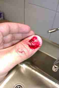 Joltain on kynsi irronnut